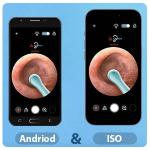 Earwax Removal Kit for IOS Phones Violet Ear Canal Cleaner with 1296P Camera 5 Ear Spoons